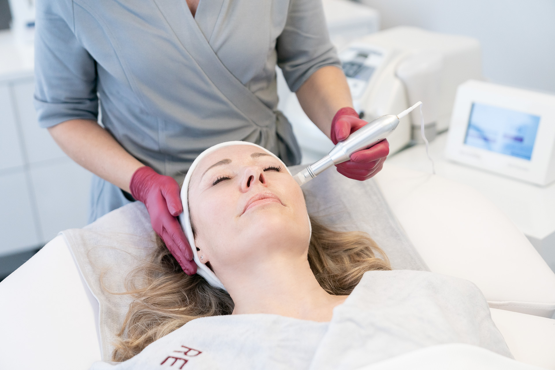 Micro-Needling Behandlung mit dem REVIDERM SkinNeedler bei REVIDERM skinmedics baden